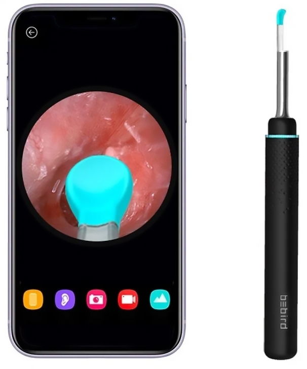 Xiaomi Bebird M9 Pro (Black)
